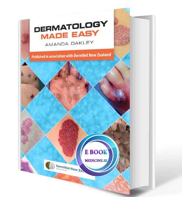 دانلود کتابDermatology Made Easy2017 (ORIGINAL PDF)